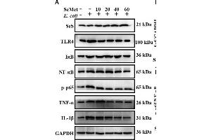 Image no. 1 for anti-Nuclear Factor-kB p65 (NFkBP65) (pSer536) antibody (ABIN730528)