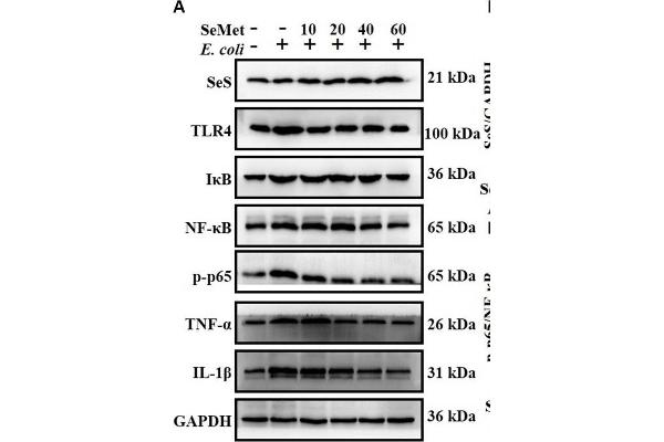 anti-Nuclear Factor-kB p65 (NFkBP65) (pSer536) antibody