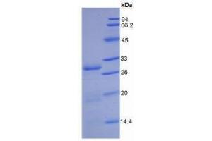 DPP4 ELISA Kit