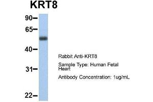 Image no. 1 for anti-Keratin 8 (KRT8) (Middle Region) antibody (ABIN2777113)