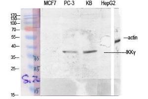 Image no. 2 for anti-Inhibitor of kappa Light Polypeptide Gene Enhancer in B-Cells, Kinase gamma (IKBKG) (Tyr363) antibody (ABIN3185154)