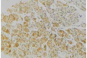 Image no. 2 for anti-Major Histocompatibility Complex, Class II, DR beta 3 (HLA-DRB3) antibody (ABIN6262292)