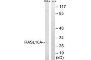 Image no. 1 for anti-RAS-Like, Family 10, Member A (RASL10A) (AA 107-156) antibody (ABIN1535266)