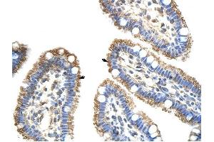 Image no. 1 for anti-Frizzled Family Receptor 9 (FZD9) antibody (ABIN630125)
