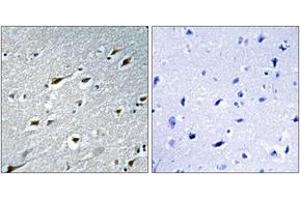 Image no. 1 for anti-Heart and Neural Crest Derivatives Expressed 1 (HAND1) (AA 71-120) antibody (ABIN1532673)