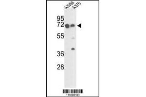 Image no. 1 for anti-FK506 Binding Protein 10, 65 KDa (FKBP10) (C-Term) antibody (ABIN2436884)