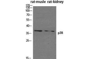 Image no. 2 for anti-Mitogen-Activated Protein Kinase 14 (MAPK14) (Ser272) antibody (ABIN3186259)