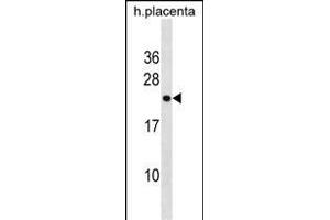 RN Antibody (Center) (ABIN1538656 and ABIN2850184) western blot analysis in human placenta tissue lysates (35 μg/lane).