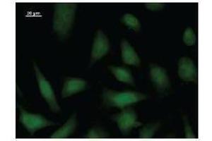Image no. 1 for anti-DNA Repair Protein Complementing XP-B Cells (ERCC3) antibody (ABIN931186)