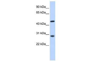 Image no. 1 for anti-Pygopus Homolog 2 (PYGO2) (N-Term) antibody (ABIN2784477)