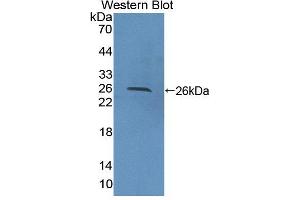 Image no. 2 for anti-Protein tyrosine Phosphatase, Non-Receptor Type 21 (PTPN21) (AA 981-1174) antibody (ABIN5014222)