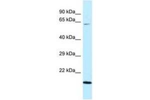 Image no. 1 for anti-DnaJ (Hsp40) Homolog, Subfamily C, Member 11 (DNAJC11) (AA 407-456) antibody (ABIN6747790)
