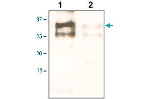 Image no. 1 for anti-Estrogen Receptor Binding Site Associated, Antigen, 9 (EBAG9) antibody (ABIN541040)