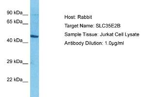 Image no. 1 for anti-Solute Carrier Family 35, Member E2B (SLC35E2B) (N-Term) antibody (ABIN2792002)