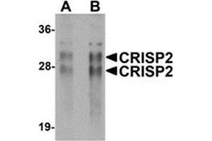 Image no. 1 for anti-Cysteine-Rich Secretory Protein 2 (CRISP2) (N-Term) antibody (ABIN783679)