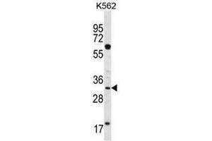 Image no. 2 for anti-Ficolin (Collagen/fibrinogen Domain Containing) 3 (Hakata Antigen) (FCN3) (AA 213-243), (C-Term) antibody (ABIN952329)