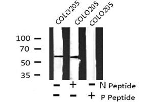 Image no. 4 for anti-3-phosphoinositide Dependent Protein Kinase-1 (PDPK1) (pTyr376) antibody (ABIN6271412)