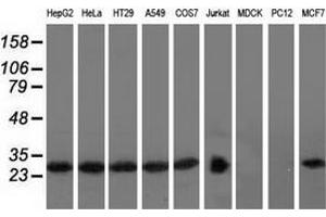 Image no. 3 for anti-RAB, Member of RAS Oncogene Family-Like 2A (RABL2A) antibody (ABIN2730382)