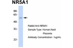 Image no. 6 for anti-Nuclear Receptor Subfamily 5, Group A, Member 1 (NR5A1) (Middle Region) antibody (ABIN2777447)