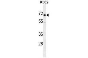 Image no. 3 for anti-Insulin-Like Growth Factor 2 mRNA Binding Protein 1 (IGF2BP1) (AA 515-542), (C-Term) antibody (ABIN952833)