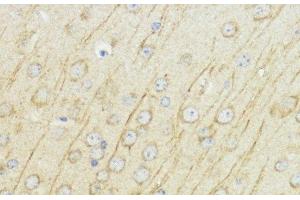 IGF1 antibody