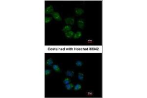 Image no. 2 for anti-Heat Shock 70kDa Protein 1-Like (HSPA1L) (Center) antibody (ABIN2856050)