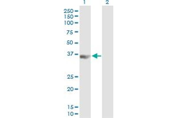 anti-Poly(rC) Binding Protein 3 (PCBP3) (AA 1-313) antibody