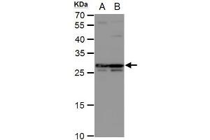 Image no. 6 for anti-Deoxycytidine Kinase (DCK) (Center) antibody (ABIN2856517)