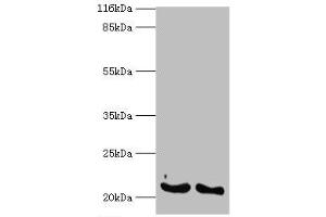 Image no. 1 for anti-Interferon, alpha 14 (IFNa14) (AA 24-189) antibody (ABIN2935134)