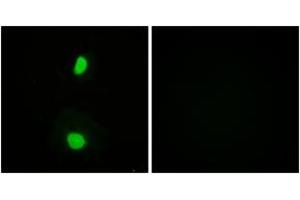Image no. 2 for anti-K(lysine) Acetyltransferase 5 (KAT5) (AA 52-101) antibody (ABIN1532534)