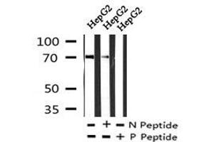 Image no. 4 for anti-Male Germ Cell-Associated Kinase (MAK) (pThr1579) antibody (ABIN6269927)