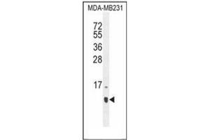 Image no. 2 for anti-Host Cell Factor C1 Regulator 1 (XPO1 Dependent) (HCFC1R1) (AA 1-30), (N-Term) antibody (ABIN952687)