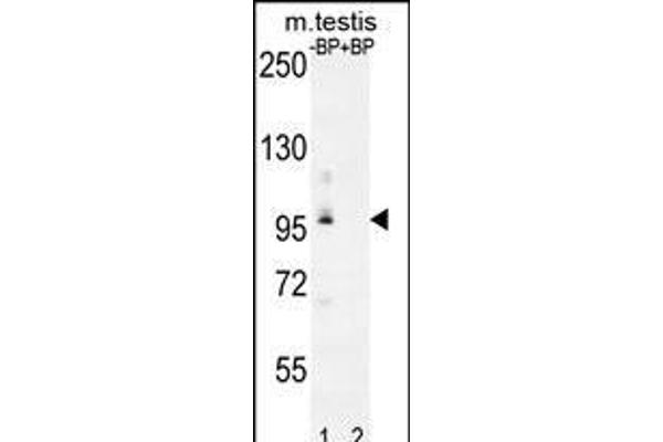PDPR antibody  (C-Term)